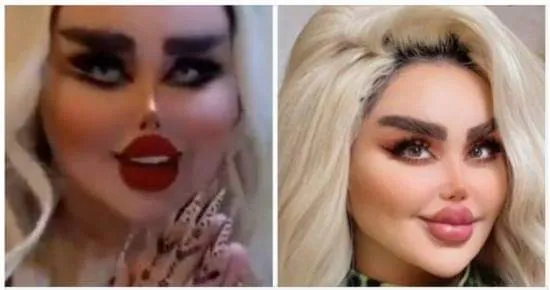 She underwent 43 cosmetic surgeries to transform into a Barbie doll, yet detractors argue she resembles a ‘zombie.’