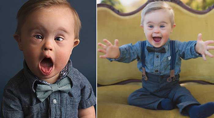 Agency refuses to let boy with Down syndrome model their clothes